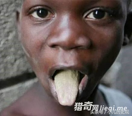 �����˰�ëë�浱��ʳ����Ӥ����ëë���Ƴɵ��࣬��ʮ����Ӫ��(1)