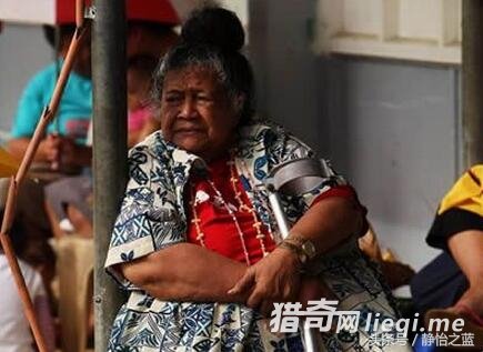 ��Ϊȫ���ԣ�Ĺ���֮һ�������ź���״�����Ǵ���ٹ���Ǩ(3)